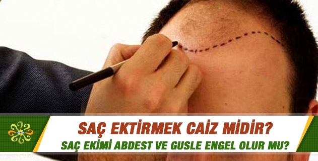 Saç ektirmek caiz midir? Saç ekimi abdest ve gusle engel olur mu? Saç ektirmek caiz midir? Saç ekimi abdest ve gusle engel olur mu?